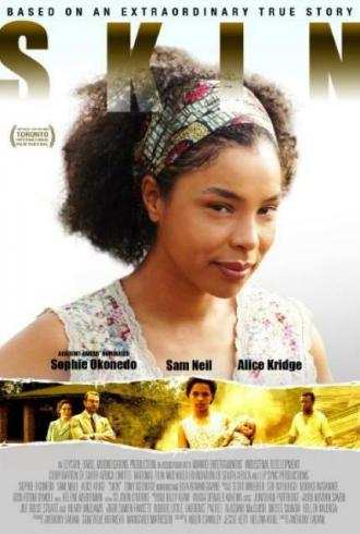Skin (movie 2009)