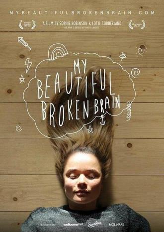 My Beautiful Broken Brain (movie 2014)